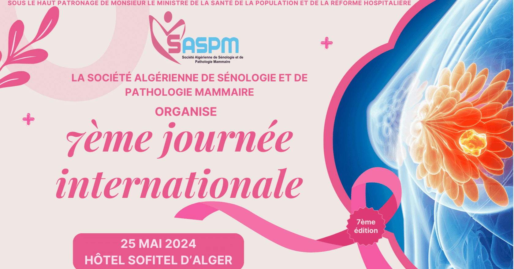 7ème journée internationale de la Société Algérienne de Sénologie et De Pathologie Mammaire (SASPM) (SASPM)